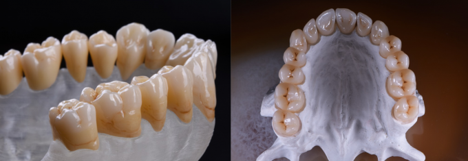 High Translucent 1200MPA 1530 ℃ Blok Zirkonia Gigi 0