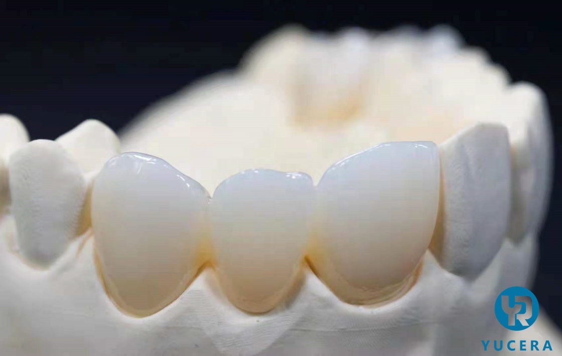 Yucera SHT Multilayer Zirconia Block 95 mm  Dental Material CAD CAM Crown and Bridge