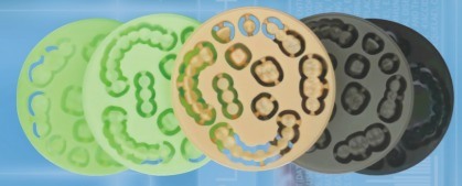 Cakram PMMA Berkualitas Tinggi Yucera Dengan Layanan OEM Bahan Gigi untuk Laboratorium Gigi