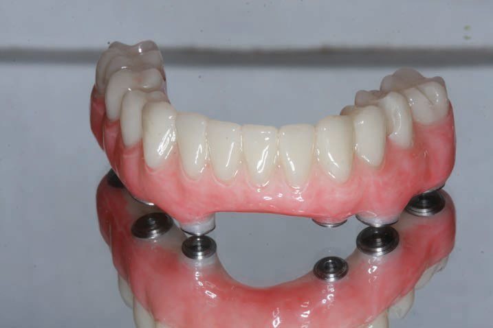 Yucera Cad Cam Multi Pmma Disk Bahan Gigi Cakram Pmma Blok Pmma Fleksibel Blok Resin Pmma