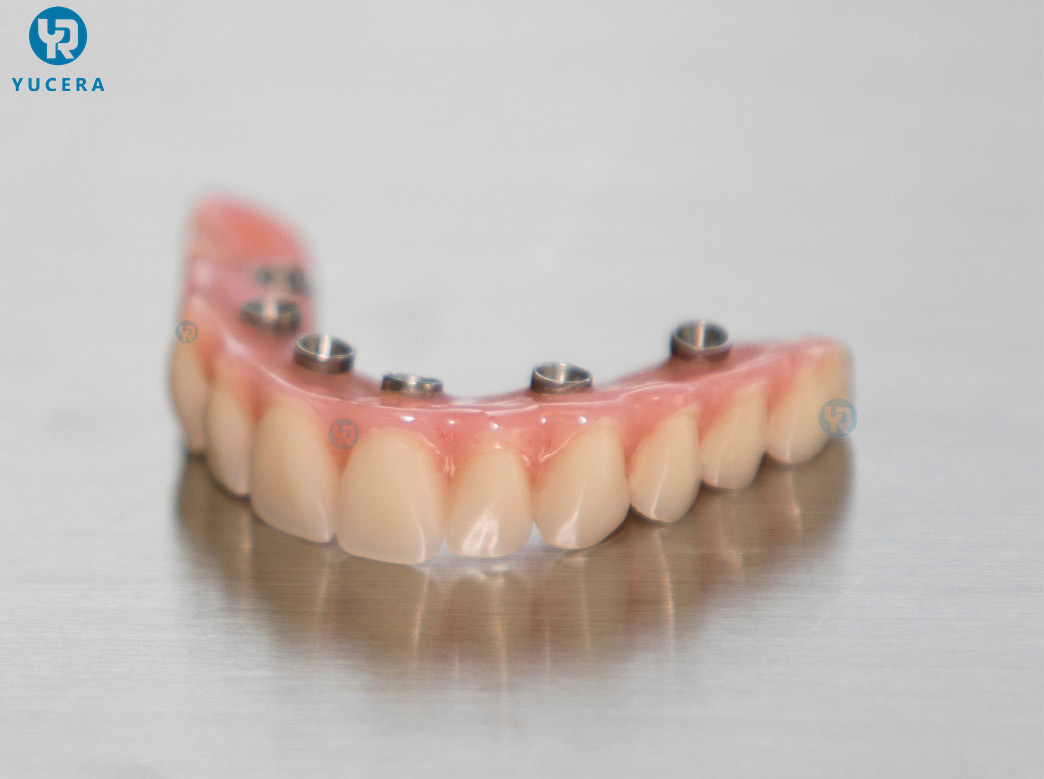 Yucera Durable Dental Monolayer PMMA untuk Manufaktur Prostetik Gigi yang Andal dan Berkualitas Tinggi