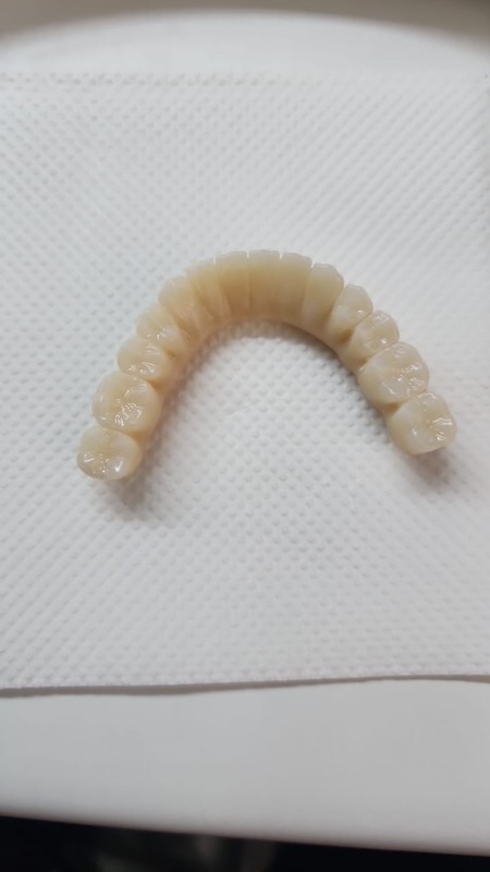 Yucera 4D Pro Tinggi - Presisi Tinggi 3D Multilayer Dental Zirkonia Block Stabil dan Andal Menciptakan Hasil Restorasi Ideal