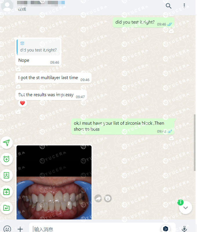 Blok Zirkonia Gigi Yucera 4D Pro - Dibuat dengan Presisi untuk Laboratorium Gigi