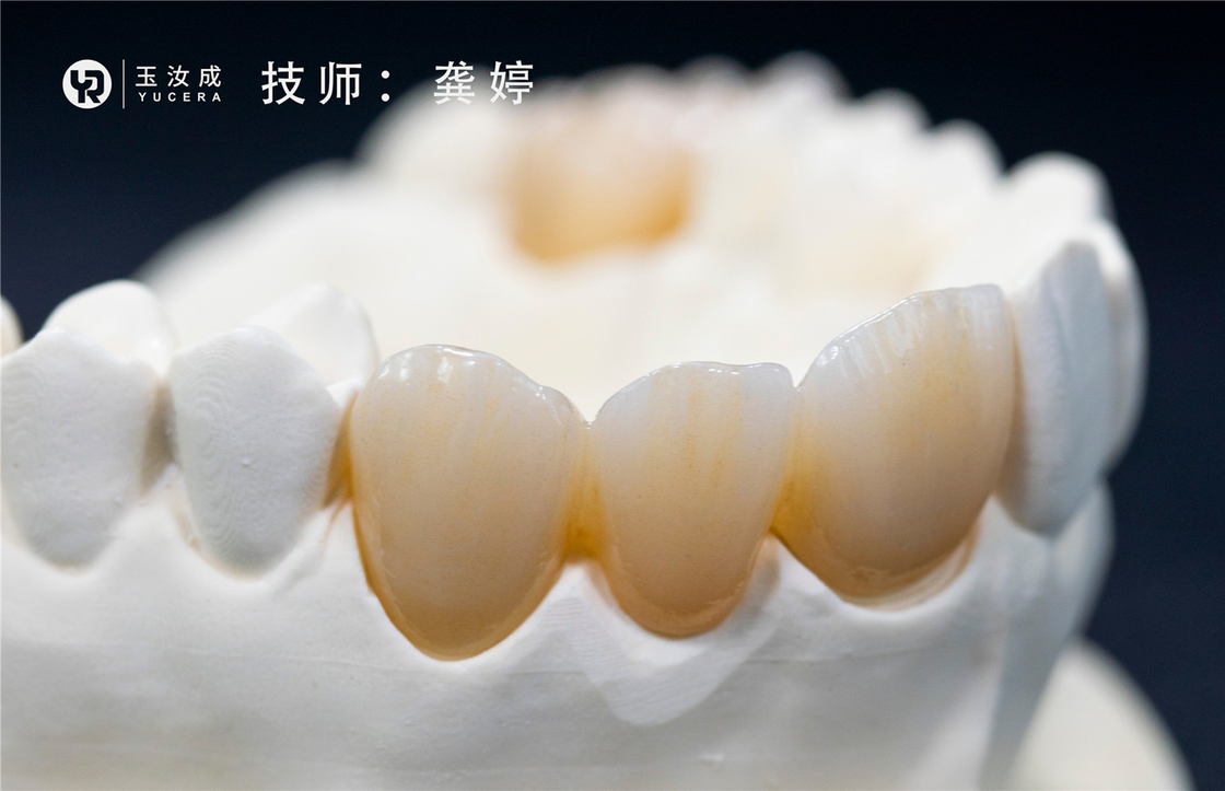 Yucera 3D Plus Multilaer Zirconia Block 98x16mm Sistem Terbuka Untuk Mahkota Posterior
